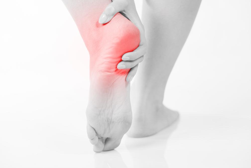 Plantar Fasciitis